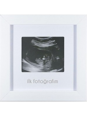 Royal Rain Store Ilk Fotoğrafım Bebek Ultrason Çerçevesi - Bebek Odası Resim Anı Çerçevesi