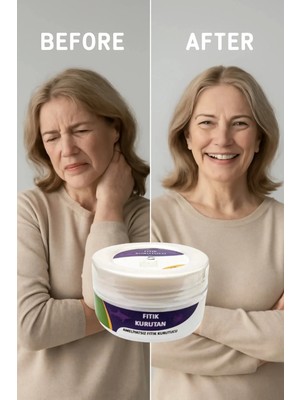 Nacario Süper Fıtık Kurutan Krem 50 ml