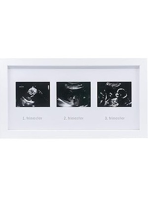 Starseven Fufi̇zu Üçlü Ultrason Anı Çerçevesi - Gebelikte Bebeğin Gelişimini Üç Trimester Anı Olarak Saklayın