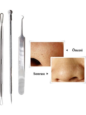 Kuzgun Ticaret Paslanmaz Çelik Siyah Nokta Sivilce ve Akne Temizleyici Set 3'lü Kit ( Lisinya )