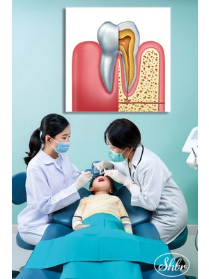 Şehber Tekli Kare Kanvas Dekoratif Duvar Tablosu Dişçi Ağız ve Diş Sağlığı Diş Polikliniği Hastahane