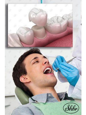 Şehzat Tekli Yatay Dekoratif Kanvas Tablo Dişçi Ağız Diş Sağlığı Poliklinik Hastahane Diş Kaplama