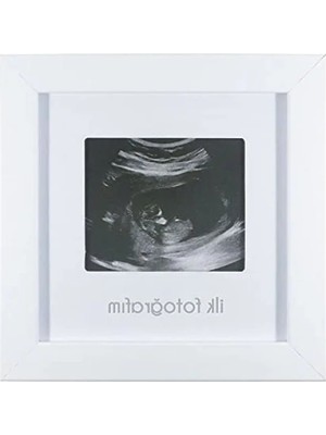 Esranın Dünyası Bebek Ultrason Fotoğrafı Için Anı Çerçevesi - Güvenli Tasarım