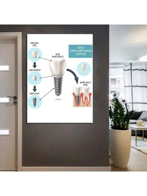 Şehzat Ağız ve Diş Sağlığı Polikliniği Tabloları Dekoratif Diş, Dekoratif Dişçi, Dişçi Dekorasyonu Dsc-58