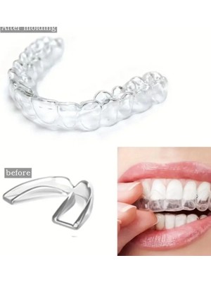 Nuveden 515 Bruksizm Gece Aparatı Plağı