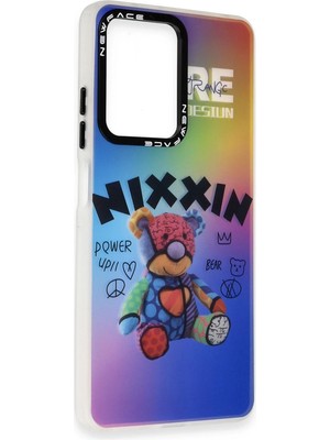 Nacario Mey Ithalat®   Redmi Note 12 4g Kılıf Estoril Desenli Kapak - Estoril - 11