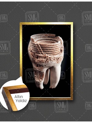 SML Tablo Diş Muayanehane Dental Sağlık Roma Kolezyum Dikey Çerçeveli Kanvas Tablo
