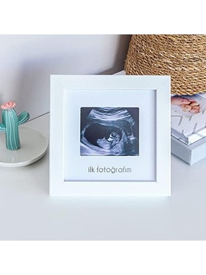 Mabeyn Ilk Fotoğrafım Bebek Ultrason Çerçevesi - Bebek Odası Resim Anı Çerçevesi