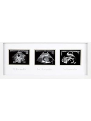 Assess Store 87038 Trimester Sonogram Frame Deluxe, Fotoğraf Çerçevesi Için Üç Ultraschallaufnahmen, Beyaz