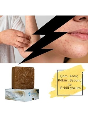 Assess Store Soap 1978 Antioch Koleksiyonu Çam Ardıç Kükürt Doğal Özel Üretim Egzama Sivilce 1 Kalıbı 130 Gr. Tekli Paket