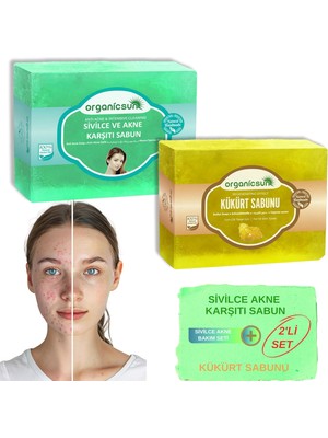 Daisy Home 2'li Set Doğal Kükürt Sabunu ve Sivilce ve Akne Karşıtı Sabun Sivilce Karşıtı Sabun Seti