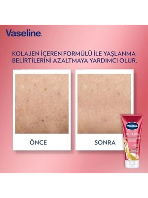 Ala Store Gluta-Hya Serum Etkili Vücut Losyonu, Sıkılaştırıcı, 200 Mililitre