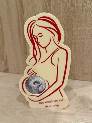 DU&ER Ultrasound Picture Frame – Bebek Sonogram Fotoğraf Çerçevesi Hamilelik Hatıra Dekor