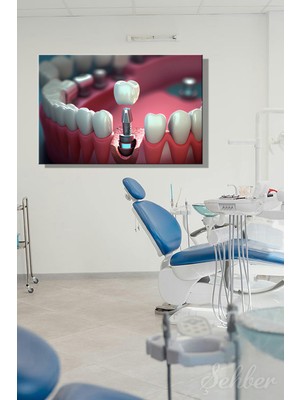 Şehber Dekoratif Yatay Kanvas Tablo Tekli  Ağız Diş Sağlığı Dişçi Poliklinik Hastane Dental Implant 894