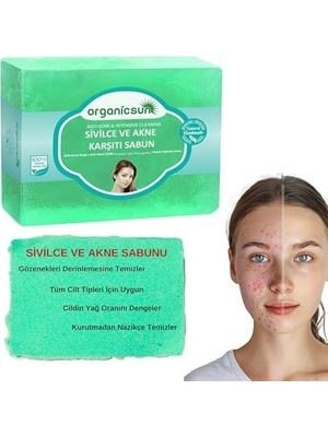 Tech Butiq Doğal Akne ve Sivilce Karşıtı Sabun 140 gr 1 Adet Tüm Cilt Tipleri Için Natural Sabun