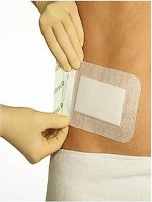 Esnek Steril (Nonwoven) Yara Örtüsü 5cm*7.5cm (10 Adet)