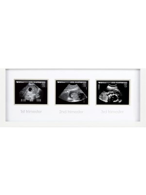 Defne Store 87038 Trimester Sonogram Frame Deluxe, Fotoğraf Çerçevesi Için Üç Ultraschallaufnahmen, Beyaz