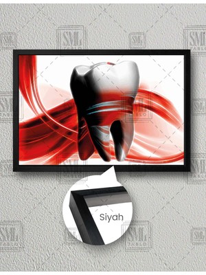 SML Tablo Ağız Sağlığı Diş Hekimi Büro Dental Art Dekoratif Yatay Çerçeveli Kanvas Tablo