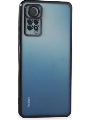 Fırsatkolik Xiaomi Redmi Note 11 Pro Kılıf Razer Lensli Silikon - Siyah