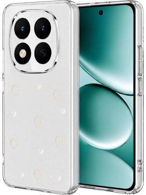 AKM Newface Xiaomi Redmi Note 15 Pro Plus 5g Fiyonk Desenli Kapak - Desen 10