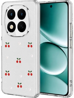 AKM Newface Xiaomi Redmi Note 15 Pro Plus 5g Fiyonk Desenli Kapak - Desen 9