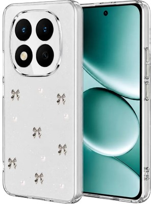 AKM Newface Xiaomi Redmi Note 15 Pro 4g Fiyonk Desenli Kapak - Desen 8