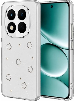 AKM Newface Xiaomi Redmi Note 15 Pro 4g Fiyonk Desenli Kapak - Desen 2