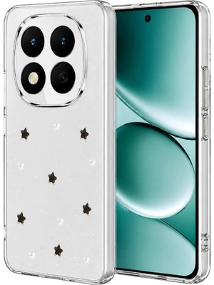 AKM Newface Xiaomi Redmi Note 15 Pro 4g Fiyonk Desenli Kapak - Desen 7