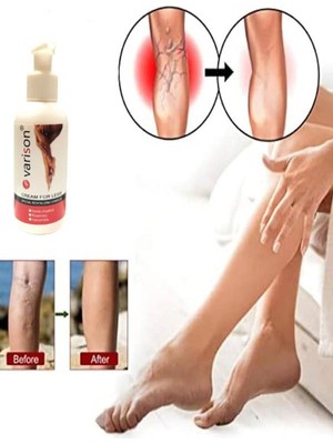 On  Sellülit Bacak Bakım Kremi 120 ml