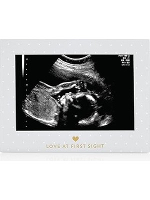 Nacario Sonogram Resim Çerçevesi Hamilelik Hatırası, Yakında Kız Bebek Veya Erkek Bebek Olacak Cinsiyetsiz