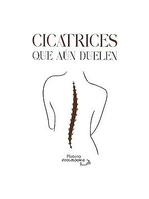 Nacario Cicatrices Que Aun Duelen