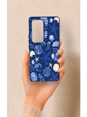 Vip Case Vivo V30 Uyumlu Deniz Kabuğu Desenli Silikon Kılıf