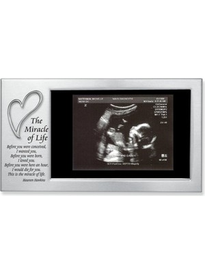 BYZ Store Cathedral Art (Abbey & Ca Miracle Of Life Kalp Bebek Çerçevesi, 12WX5L, Gri