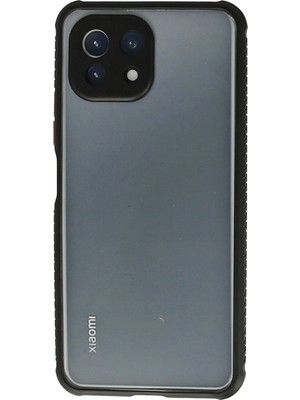 Muratech Newface Xiaomi Mi 11 Lite Kılıf Miami Şeffaf Silikon - Siyah