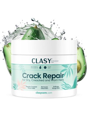 Clasy Topuk Çatlağı Kremi – Kuru Çatlamış Topuklar Için – E Vitamini Avokado Yağlı Topuk Kremi – Nasır, Se