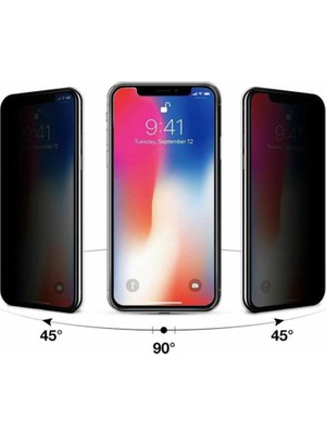Aydogan's Ayd Xiaomi Mi 15 Razer Lensli Silikon - Siyah