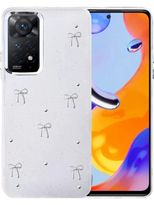 Durukar®   Redmi Note 11 Pro Fiyonk Desenli Kapak - Desen 5