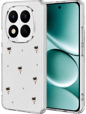 Muratech Newface Xiaomi Redmi Note 15 Pro Plus 5g Fiyonk Desenli Kapak - Desen 1