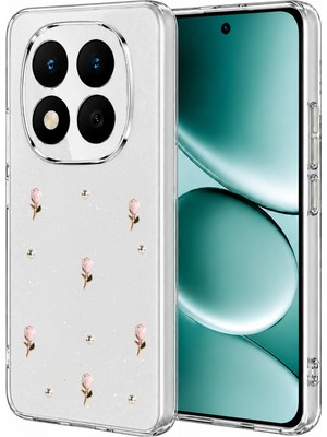 Muratech Newface Xiaomi Redmi Note 15 Pro 4g Fiyonk Desenli Kapak - Desen 6
