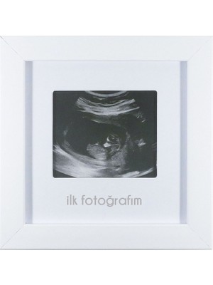 1001 Fotoğrafım Bebek Ultrason Çerçevesi - Bebek Odası Resim Anı Çerçevesi