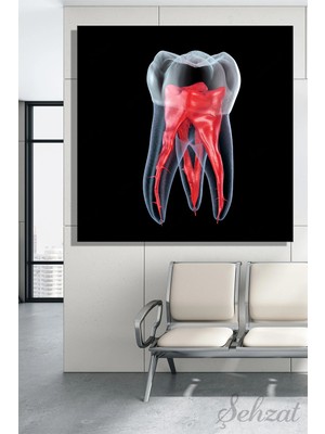 Şehzat Kare Kanvas Duvar Tablosu Tekli  Ağız Diş Sağlığı Dişçi Dental Kök Anatomisi Endodonti