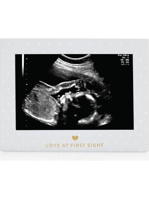 Starseven Sonogram Resim Çerçevesi Hamilelik Hatırası, Yakında Kız Bebek Veya Erkek Bebek Olacak Cinsiyetsiz