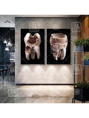 SML Tablo Diş Muayanehane Dental Ağız ve Diş Sağlığı Ikili Kombin 2 Li Set Kanvas Tablo