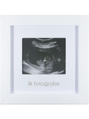 Fufizu Ilk Fotoğrafım Bebek Ultrason Çerçevesi - Bebek Odası Resim Anı Çerçevesi