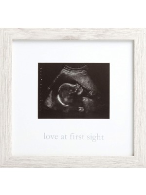 Valor Kate & Milo Rustik Sonogram Ilk Görüşte Aşk Çerçevesi, Ebeveyn Hediyesi Bekleniyor, Ultrason Resim