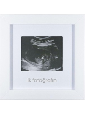 Astraltech Fufi̇zu Ilk Fotoğrafım Bebek Ultrason Çerçevesi - Bebek Odası Resim Anı Çerçevesi