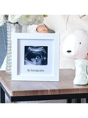 Ilk Fotoğrafım Bebek Ultrason Çerçevesi - Bebek Odası Resim Anı Çerçevesi