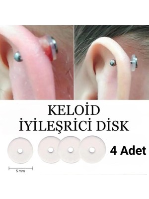 Zemira 4 Adet Bioplast Keloid Iyileştirici Önleyici Anti Hiperplazi Için Disk, Renksiz, 5 mm
