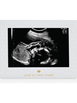 Zemira Little Blossoms Sonogram Resim Çerçevesi Hamilelik Hatırası, Yakında Kız Bebek Veya Erkek Bebek Ola