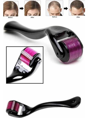 Eco Lounge Derma Roller Titanyum Uçlu 540 Iğneli 1 mm Saç Sakal Çıkarma ve Cilt Bakım Masaj Aleti